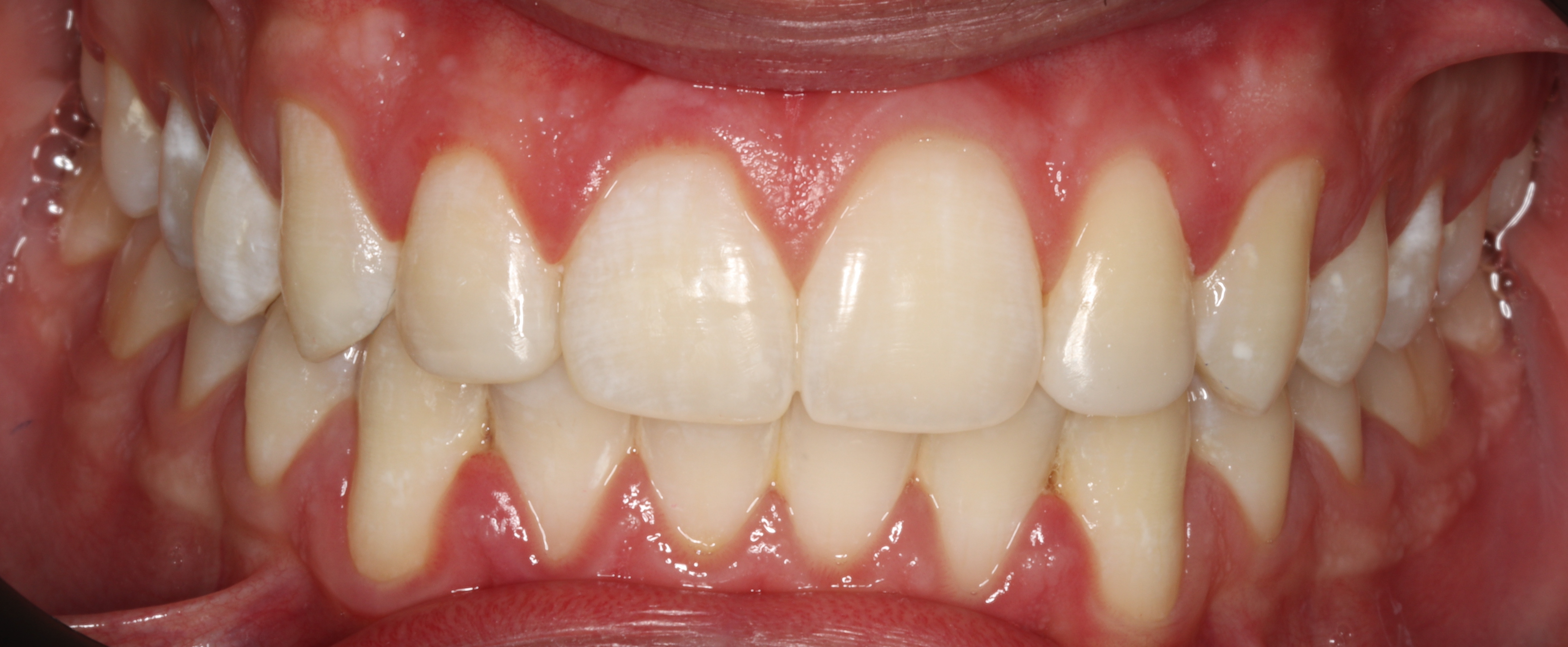Case 4 - after