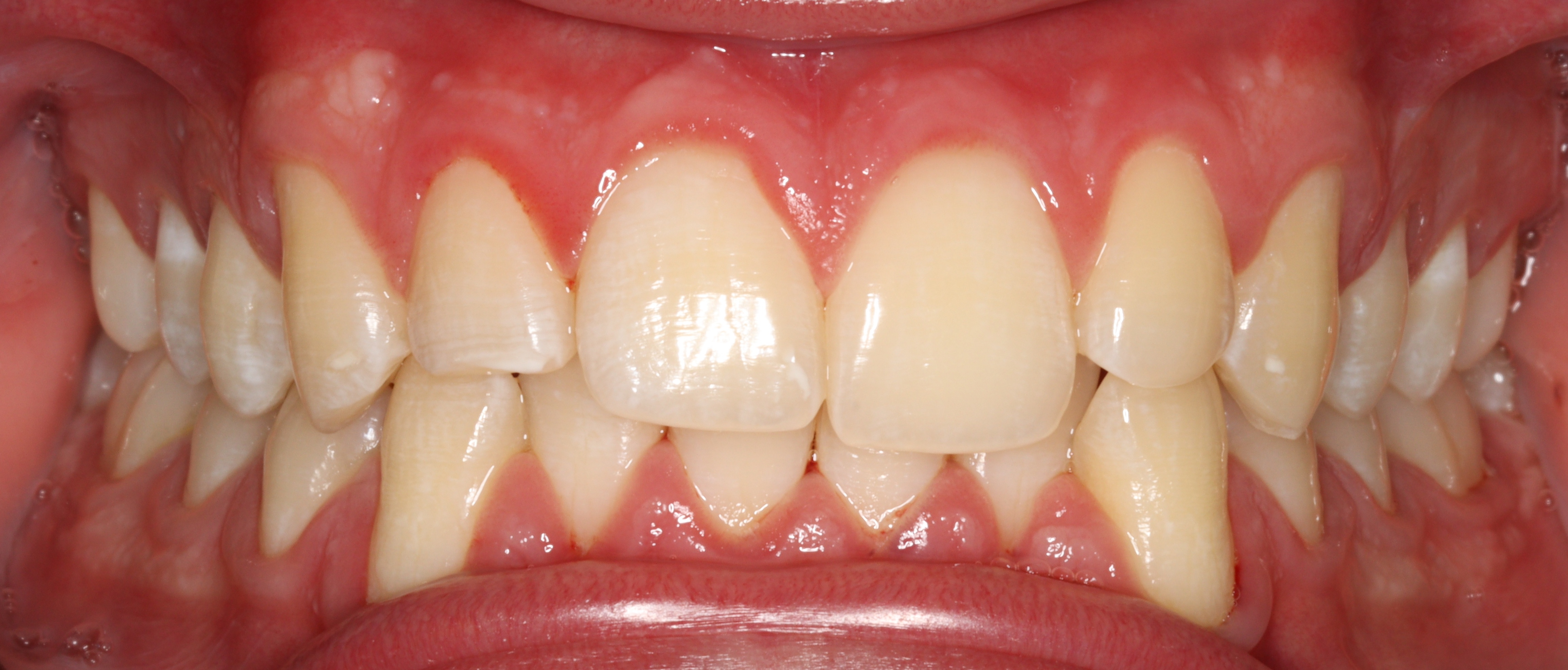 Case 4 - before