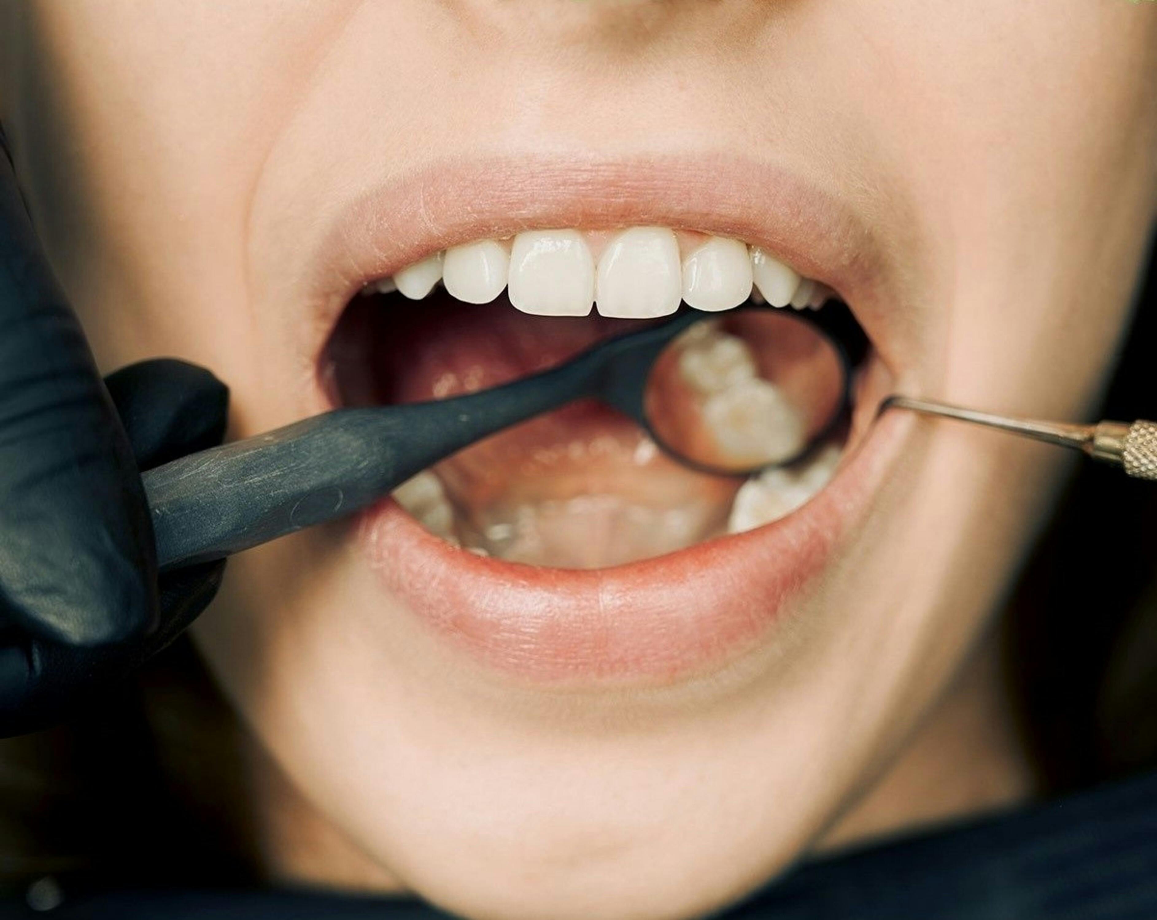 Зъбен преглед в dentAlive - дентална клиника София