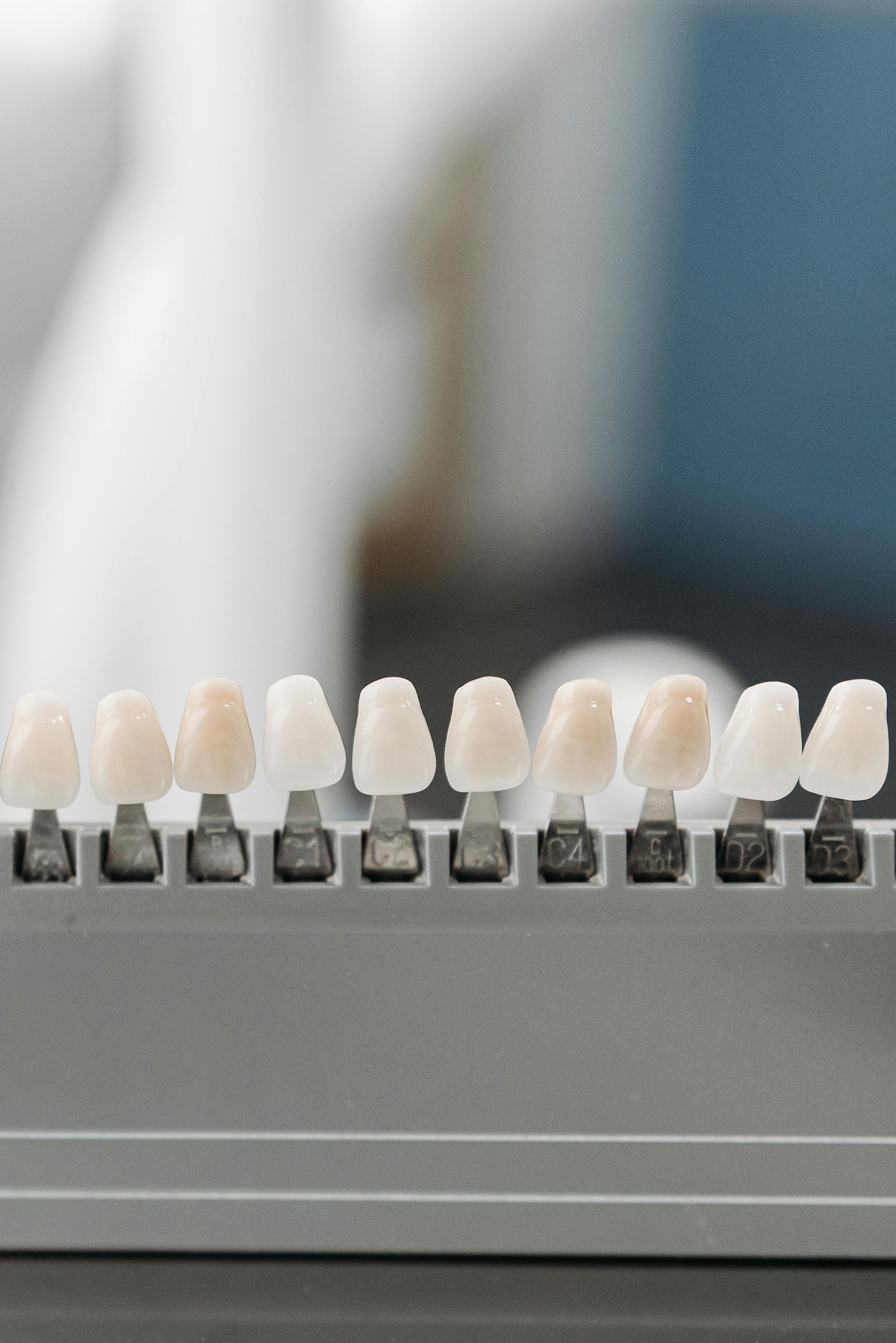 Избелване в dentAlive - дентална клиника София