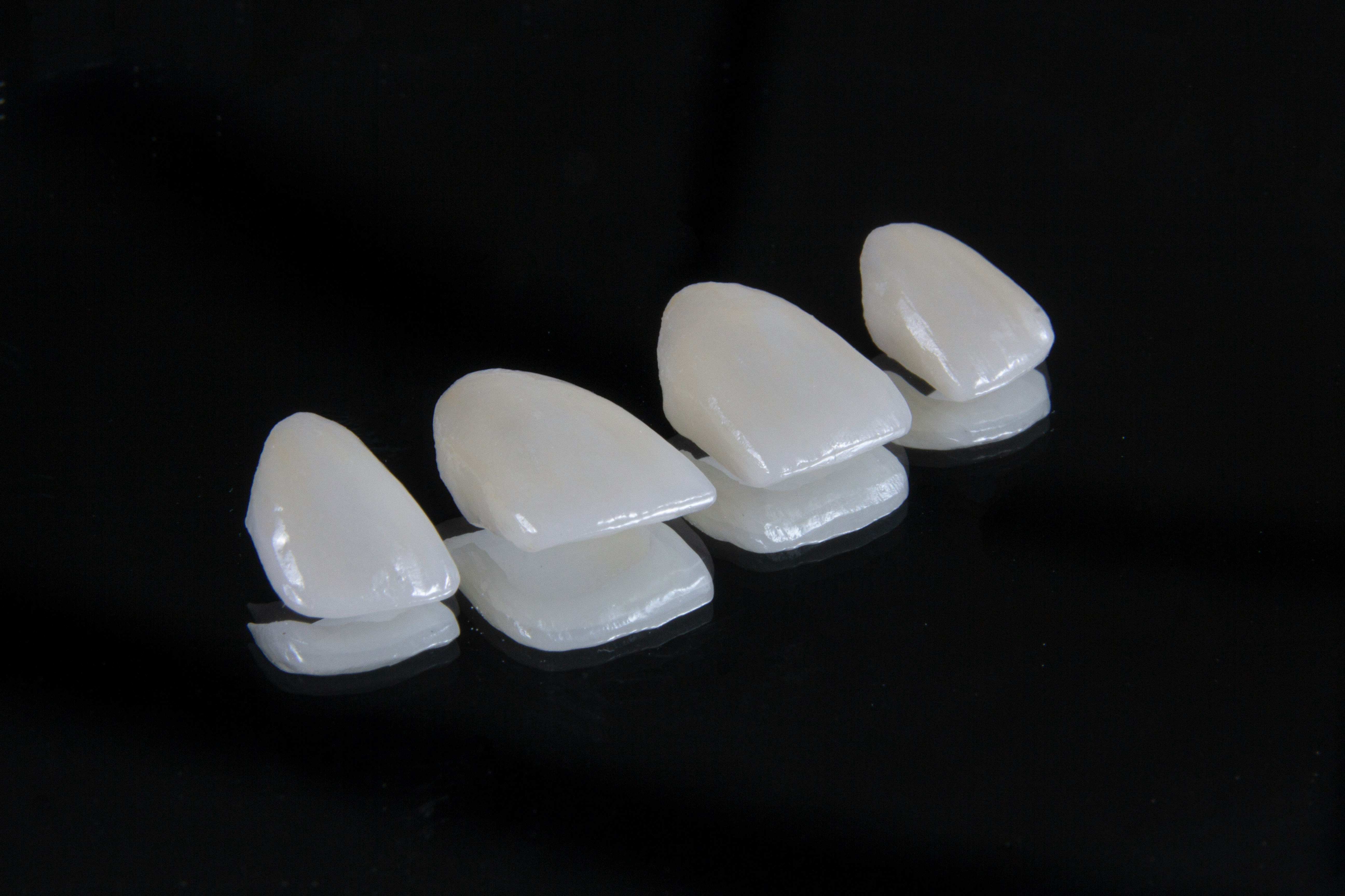 Керамични фасети в dentAlive - дентална клиника София